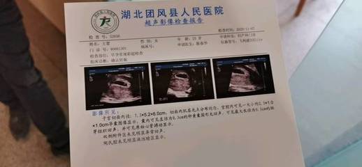 怎么测试男女宝宝最准
