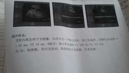 孕吐吐血丝是怎么回事