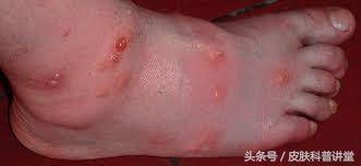 结节是怎么回事