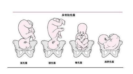 怀孕多久定胎位