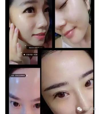 玻尿酸孕妇可以涂抹吗