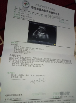 有必要做胎儿心脏彩超吗