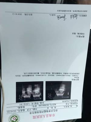 怀孕6周是多少天了