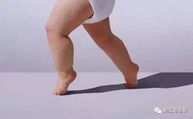 2岁宝宝踮着脚尖走路
