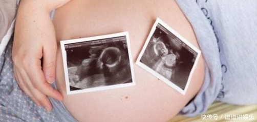 怀孕多少周开始测胎动