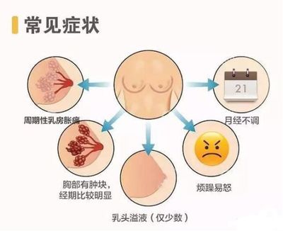 乳腺结节怎么治疗方法