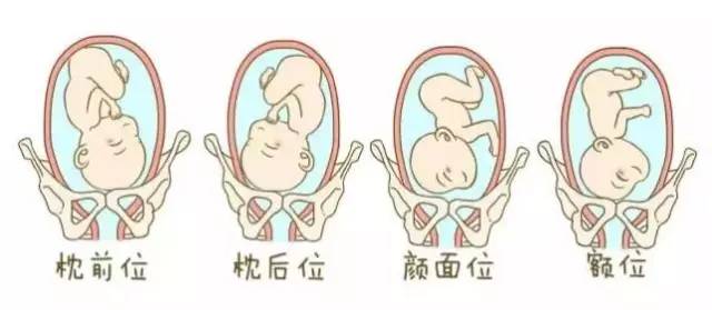 宝宝在肚子里的姿势