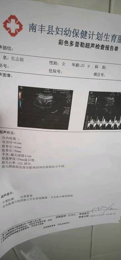 怀孕六个月做四维晚吗