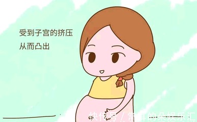 怀孕肚脐会有变化吗