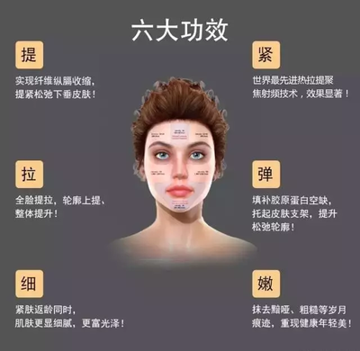 脸部射频