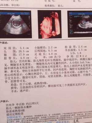 胎儿22周图片