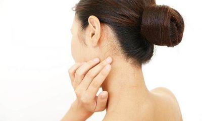 脖子上面痘痘怎么消除