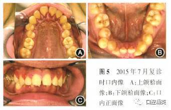 北京大学口腔医院牙周刮治多少钱