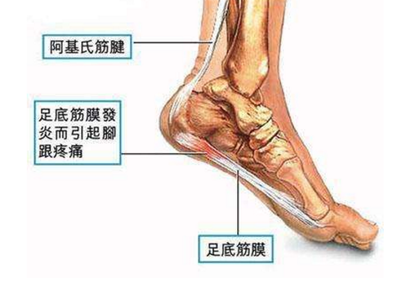 脚后跟疼是怎么回事儿