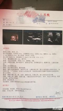 三维四维彩超几个月做