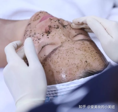 微针能不能去痘痘