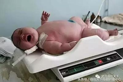 新生儿多大算巨大儿