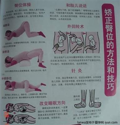 胎儿胎位什么时候固定