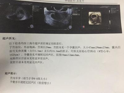 宝宝几周有胎心