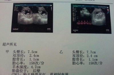 一个月双顶径能长多少