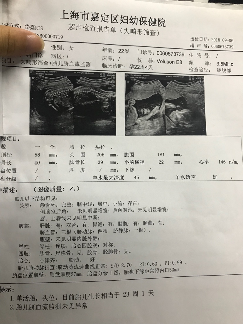 上海b超大畸形筛查多少钱