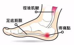 脚底内侧疼是怎么回事