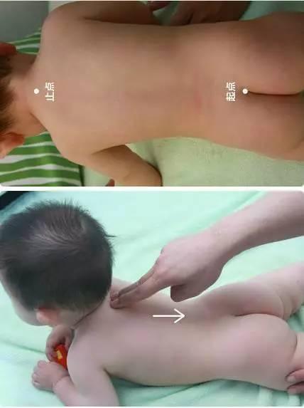 宝宝疳积