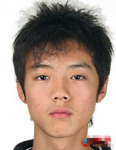 满脸痘痘的照片男