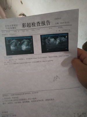 吃孕酮对胎儿有影响吗