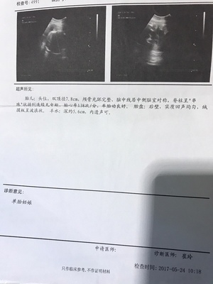 孕36周后胎儿一周一般能长重