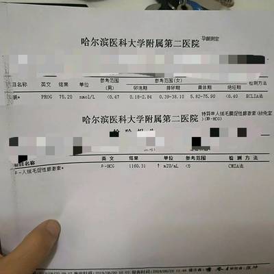 医院查排卵期怎么查