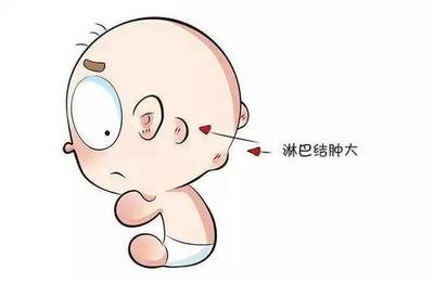 一岁宝宝耳后淋巴结肿大怎么办