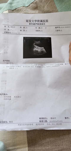 孕9周胎儿