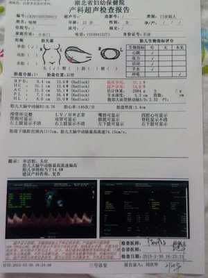 37周胎儿大脑中动脉正常值