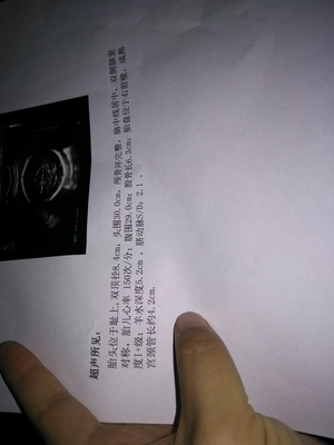 孕32周出血是怎么回事