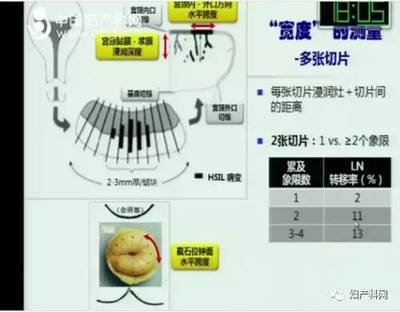 宫颈锥切冷刀手术大概多少钱