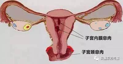 宫颈肿瘤怎么治疗