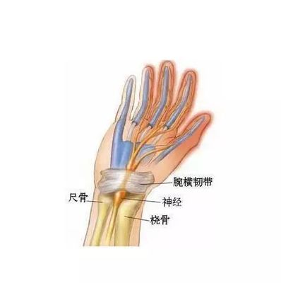 什么是腱鞘炎怎么治疗