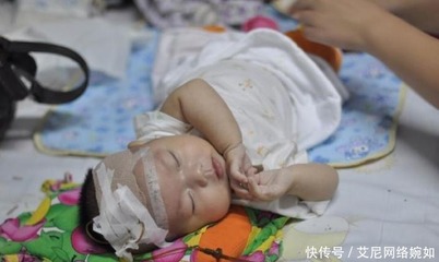 四岁宝宝反复发烧怎么办