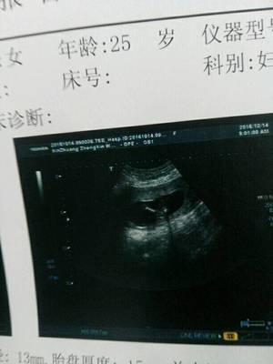 怀孕4个月能做流产吗