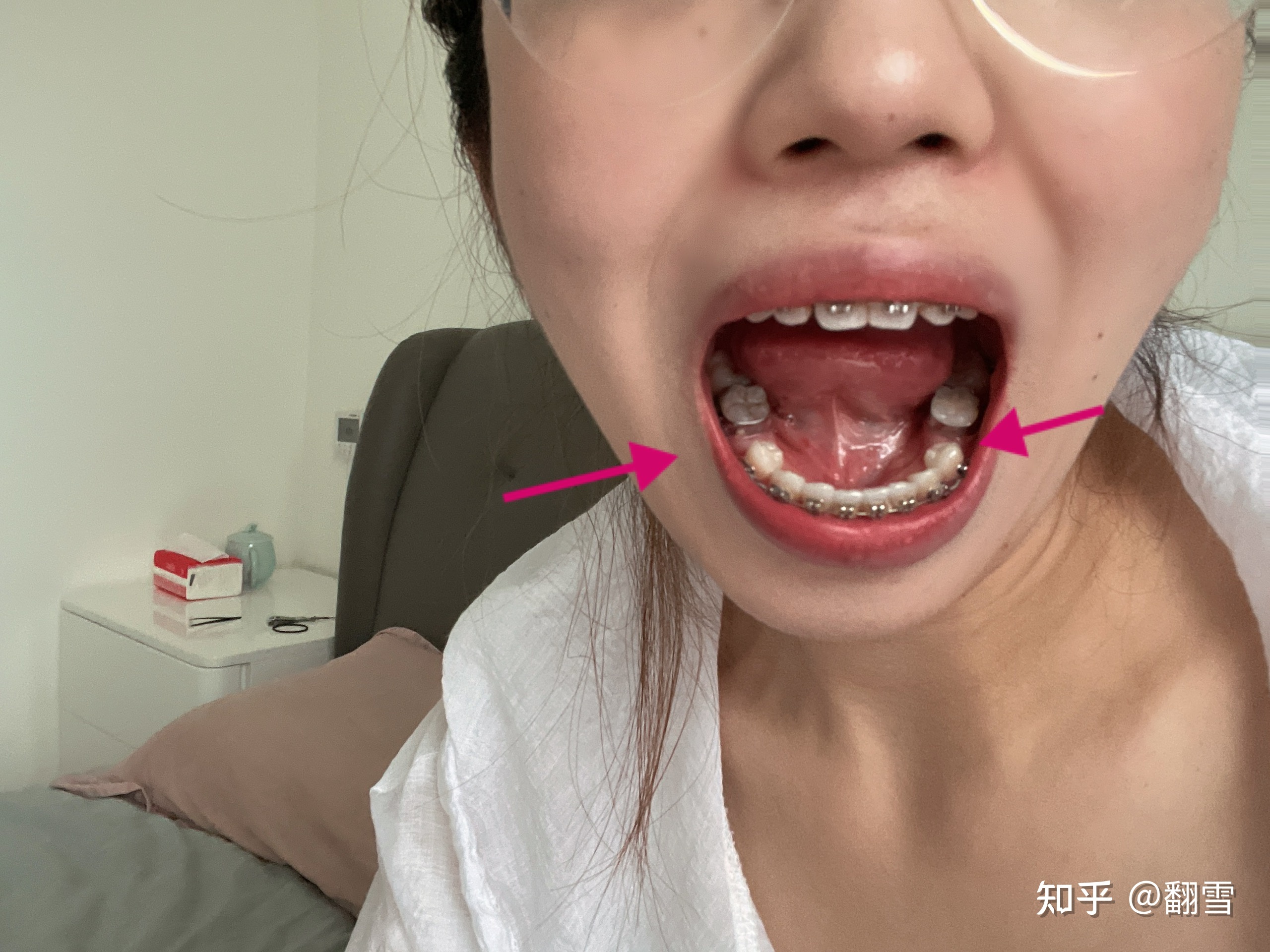 牙齿紧绷是怎么回事