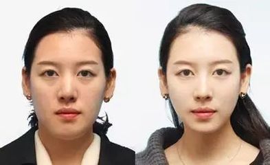 脸型变化