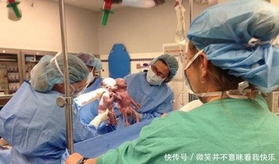 带了环还会怀孕吗