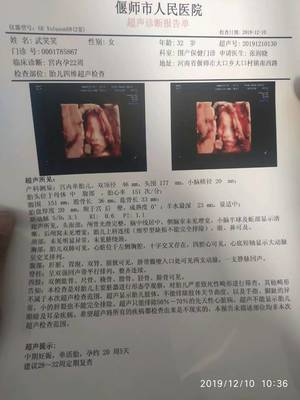 胆囊偏大是怎么回事