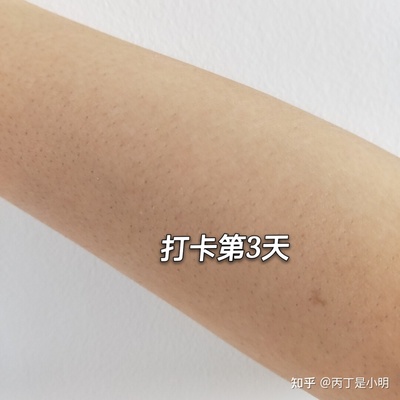 腋下有斑点是怎么回事