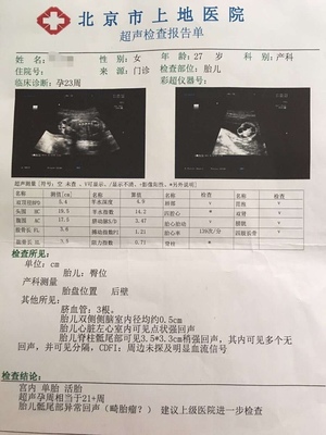 3个月做引产要住院几天