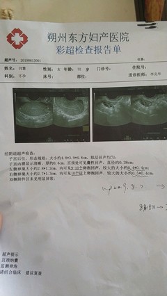 怎样做卵巢功能检查多少钱