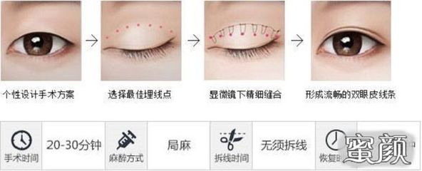 埋线好还是割好