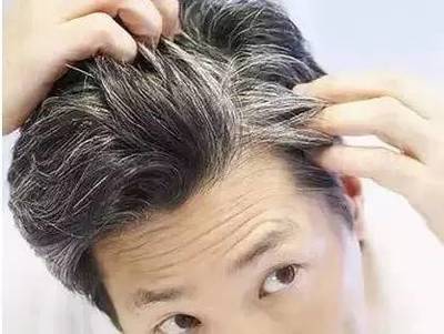 皮肤黑的人什么发型好