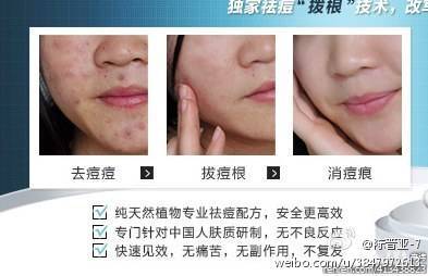 消去痘痘